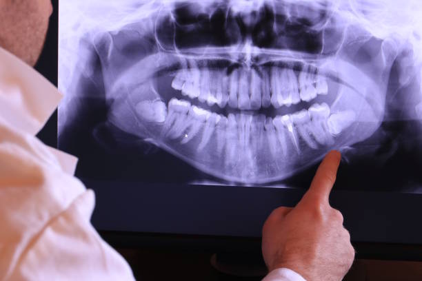 Best Emergency Treatment for Toothache in St Georges, DE