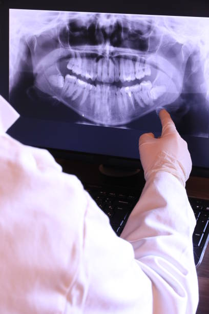 Best Emergency Tooth Extraction in St Georges, DE