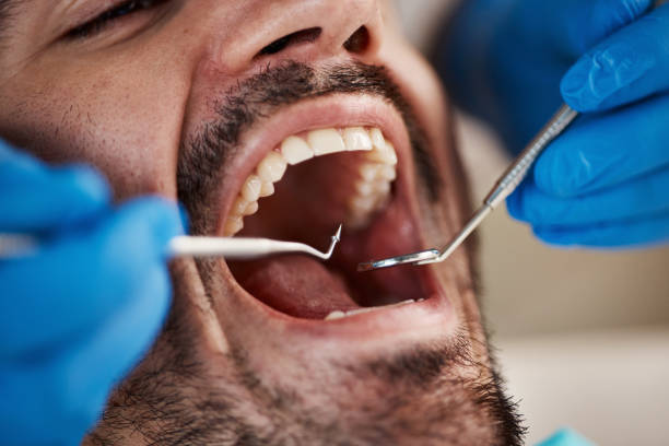Best After-Hours Emergency Dentist in St Georges, DE
